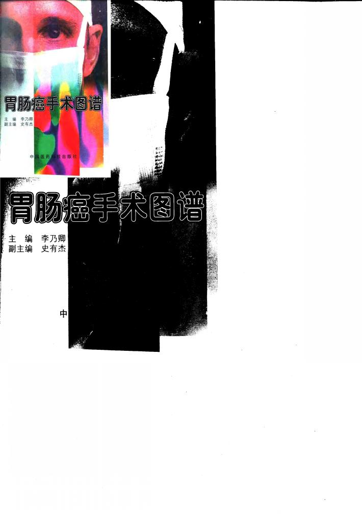 胃肠癌手术图谱 封面