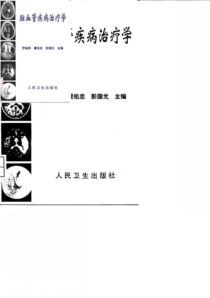 脑血管疾病治疗学 封面
