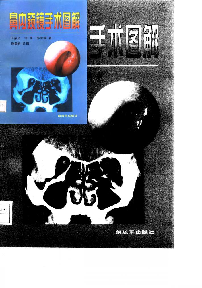 鼻内窥镜手术图解 封面