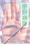 手到病除 封面