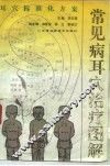 常见病耳穴治疗图解  耳穴标准化方案 封面
