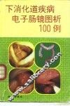 下消化道疾病电子肠镜图析100例 封面