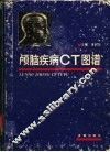 颅脑疾病CT图谱 封面