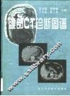 腹部CT诊断图谱 封面