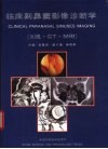 临床副鼻窦影像诊断学 X线·CT·MRI 封面