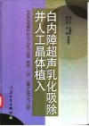 白内障超声乳化吸除并人工晶体植入 封面