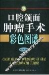 口腔颌面肿瘤手术彩色图谱 封面