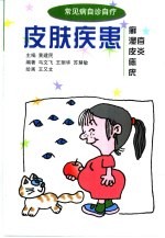皮肤疾患  癣  湿疹  皮炎  痣  疣 封面