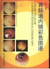 胃肠道内镜彩色图谱 封面