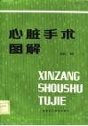心脏手术图解 封面