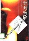 针到病除 封面