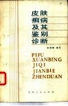 皮肤癣病及其鉴别诊断 封面