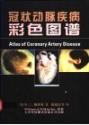冠状动脉疾病彩色图谱 封面
