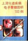 上消化道疾病电子胃镜图析100例 封面
