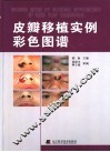 皮瓣移植实例彩色图谱 封面