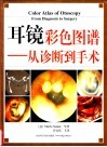 耳镜彩色图谱  从诊断到手术 封面