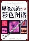 尿液沉渣实录彩色图谱 封面