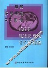 腹部多层螺旋CT图谱 封面