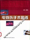 电烧伤手术图谱 封面