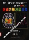 脑磁共振波谱成像 封面