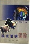 脑血管病预防 封面