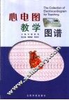 心电图教学图谱 封面