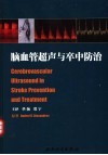 脑血管超声与卒中防治 封面