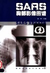SARS胸部影像图谱 封面