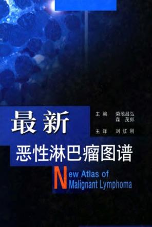 最新恶性淋巴瘤图谱 封面