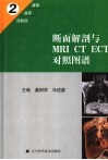 断面解剖与MRI CT ECT对照图谱 中英文本 2 腹部、盆部、四肢部 封面