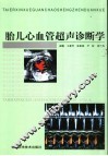 胎儿心血管超声诊断学 封面