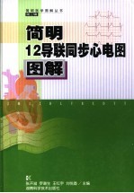 简明12导联同步心电图图解 封面