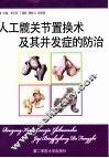 人工髋关节置换术及其并发症的防治 封面