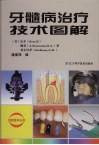 牙髓病治疗技术图解 封面