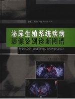 泌尿生殖系统疾病影像鉴诊断图谱 封面
