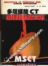 多层螺旋CT原理和临床应用 封面