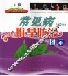 常见病推拿防治图示 封面