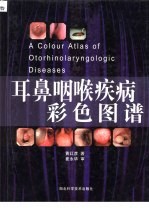 耳鼻咽喉疾病彩色图谱 封面