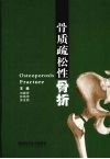 骨质疏松性骨折 封面