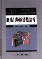 肝癌门静脉癌栓治疗 封面
