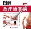 图解灸疗治百病 封面