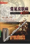常见皮肤病中西医诊疗与调养 封面