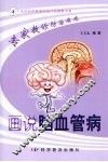 画说脑血管病 封面