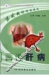 画说肝病 封面