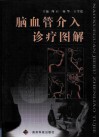 脑血管介入诊疗图解 封面