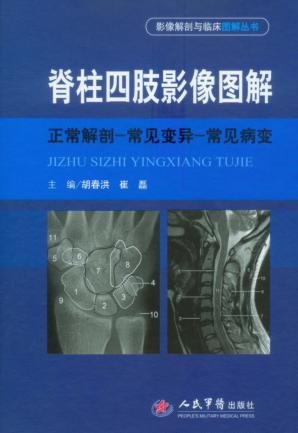 脊柱四肢影像图解  正常解剖—常见变异—常见病变 封面