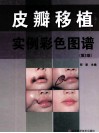皮瓣移植实例彩色图谱 封面