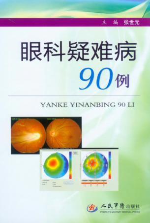 眼科疑难病90例 封面