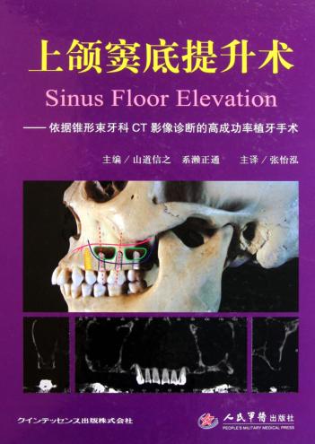 上颌窦底提升术  依据锥形束牙科CT影像诊断的高成功率植牙手术 封面
