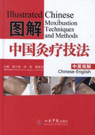 图解中国灸疗技法 封面